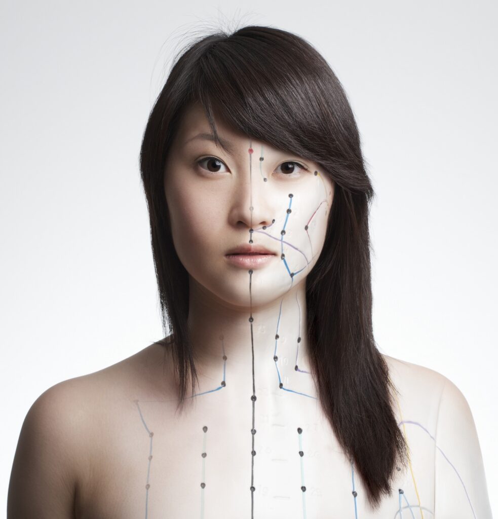 Acupuncture for Health & Wellbeing in Leeds